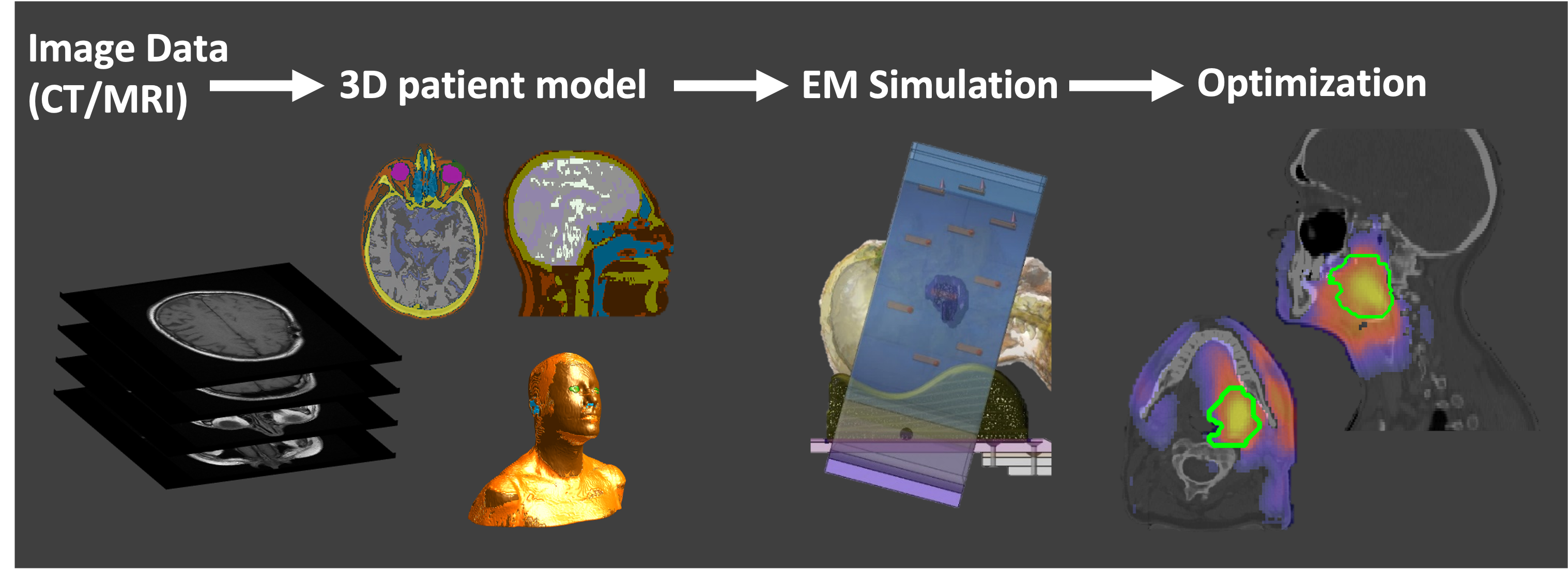 Hyperthermia treatment planning simulation