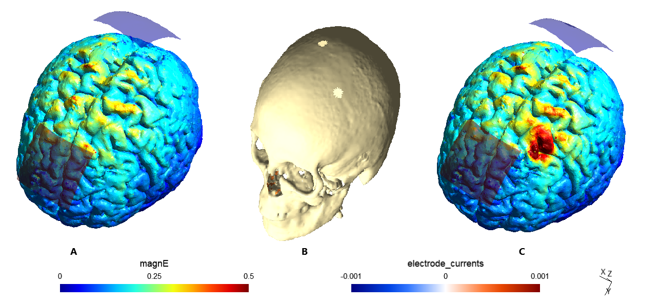 Transcranial stimulation model